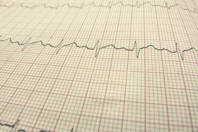 Низкий уровень сывороточного кальция – новый предиктор внезапной сердечной смерти