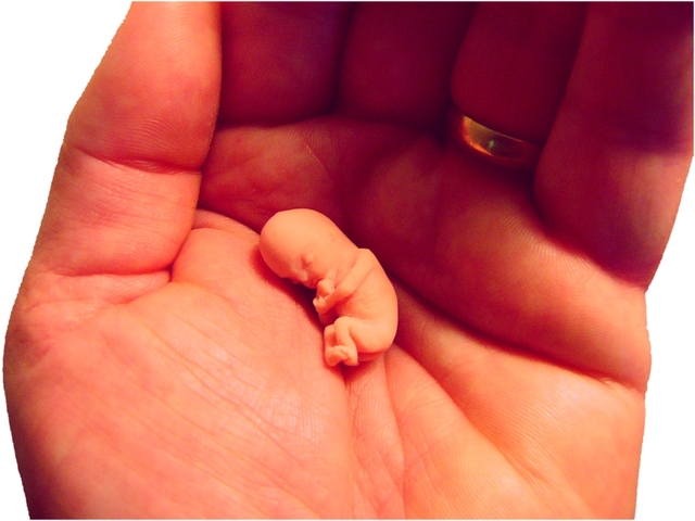 Риск внематочной беременности при ЭКО: перенос «свежих» или размороженных эмбрионов?