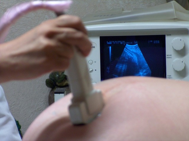 Специалисты оценили репродуктивную функцию женщин и исходы беременности после миомэктомии