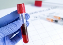 Разработан анализ крови, достоверно определяющий наличие онкологии