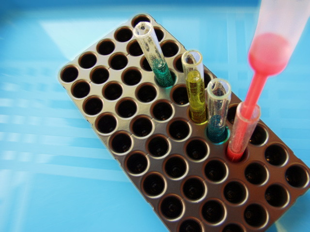 FDA допускает к использованию анализ крови, предсказывающий наличие ЧМТ